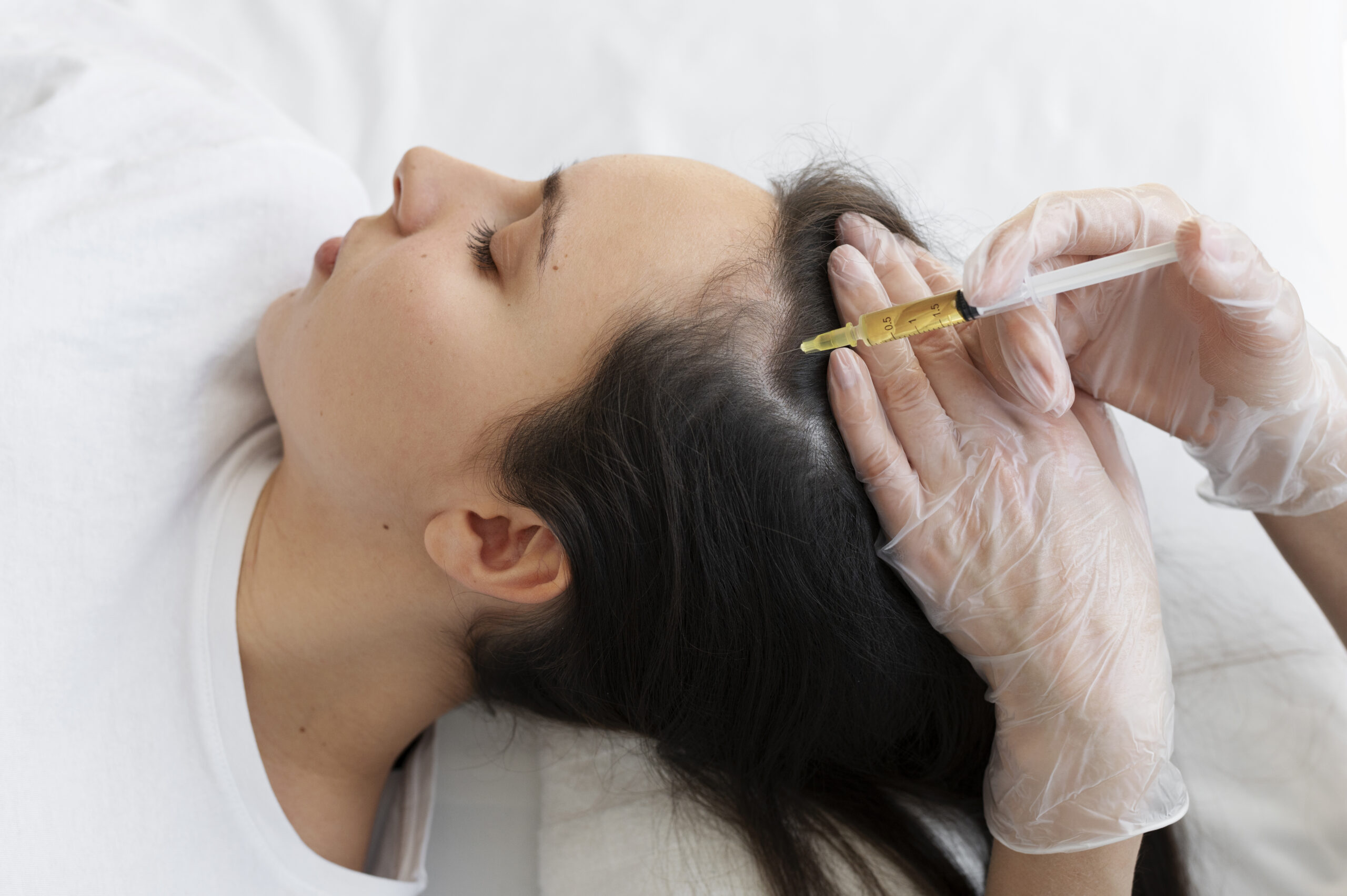 woman-getting-scalp-prp-treatment-high-angle PRP Kit Rein Duo